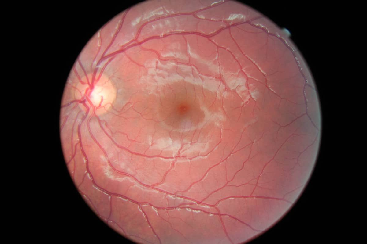 Can A Laser Pointer Really Damage Your Eyes? Premier Eye Center